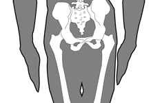 腰椎や骨盤の歪みは優柔不断や怠け癖、億劫などの行動力の低下に繋がります。